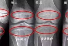 14歲男孩3年沒長(zhǎng)個(gè) 爸爸表態(tài)：家有4套房 矮不用治