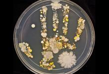 “夫妻相”如何形成？因夫妻微生物生態環境接近