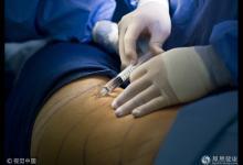 一女子手術抽脂猝死 責任人被移送檢方偵辦