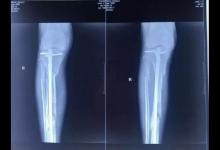 廊坊“城南醫(yī)院院長墜樓”后續(xù):楊玉忠曾被舉報侵占集體資產(chǎn)