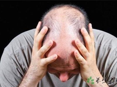 8000人報名脫發志愿者 脫發的原因有哪些