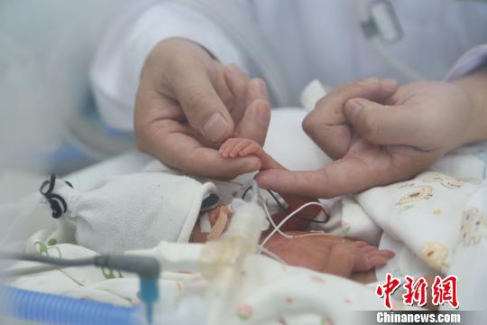 一名胎齡僅26周嬰兒從湖北恩施空中轉運武漢