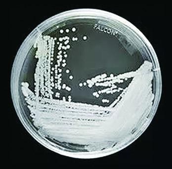 “超級(jí)真菌”來(lái)襲？這些才是真相