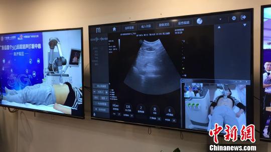 廣東省內首例5G遠程超聲診斷在廣州應用成功