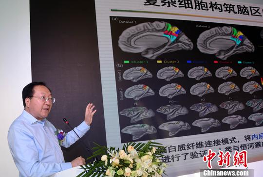 中科院自動化所腦科研成果“落地” 研發(fā)出先進腦氧檢測設備