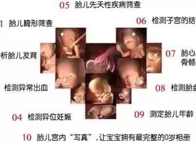 唐山寶島婦兒醫(yī)院：四維彩超檢查什么有哪些注意事項？