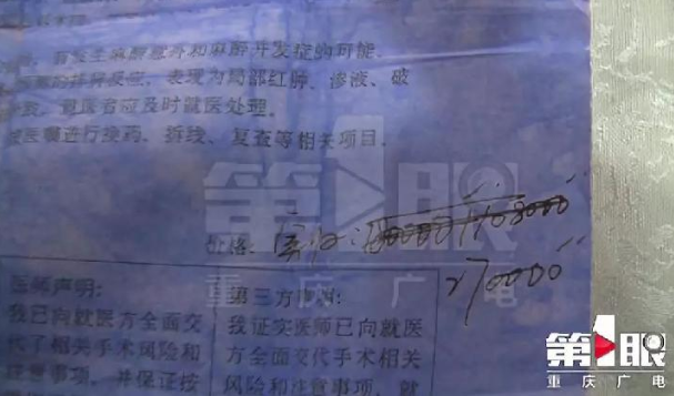 上海比華利整形醫院跟重慶某整形機構存合作關系？整形失敗拒接受采訪