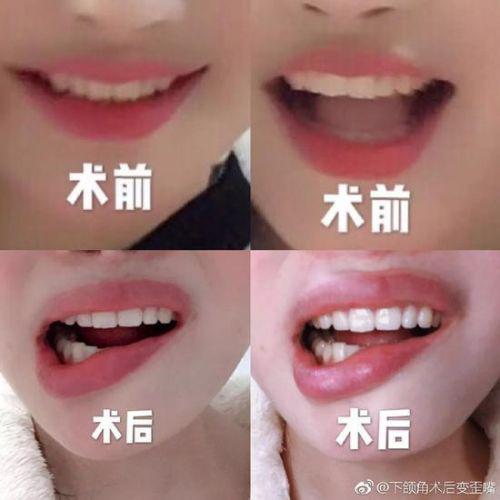 女子花3.5萬在武漢華美整形外科醫院整形致殘 院方只賠5000塊了事