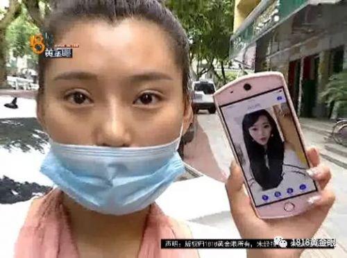 三女子整容均出現不同程度歪斜 義烏陽光美容醫院：本身就有問題