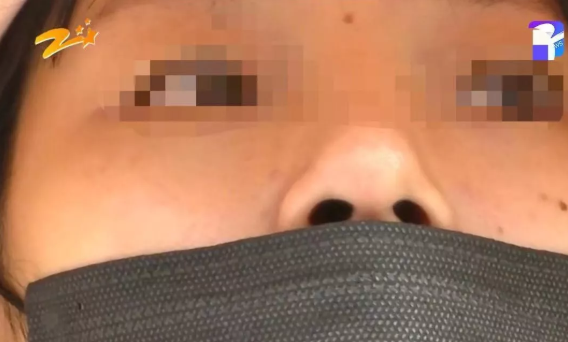 杭州甄美整形醫院把人鼻子整歪了？醫院：自己長歪了
