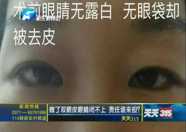 女子整形失敗 許昌華姿醫美整形醫院不認：因為醫生已離職