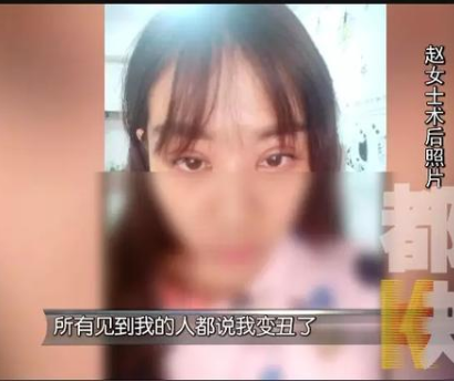 貸款6萬多在西安華醫天美整形醫院整容后變丑了 女子流下后悔的眼淚