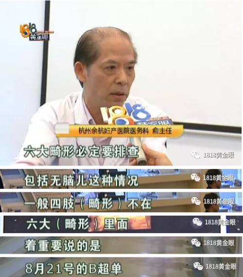 杭州余杭婦產醫院沒查出胎兒雙手畸形要不要擔責？B超能查胎兒畸形嗎？