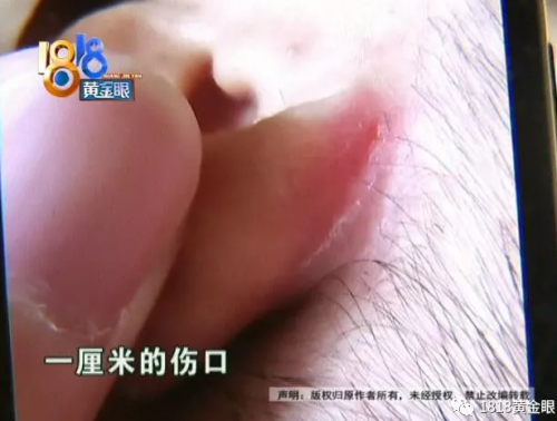 花11萬住杭州禧月閣母嬰護理中心 滿月后寶寶耳背有傷痕