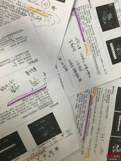 德陽市人民醫院產檢生下畸形兒:醫院稱符合診療規范 父親拒帶回家-易網健康<a href=http://m.henggaotouzi.com/jkys/ target=_blank class=infotextkey>養生</a>網 德陽市人民醫院產檢生下畸形兒:醫院稱符合診療規范 父親拒帶回家