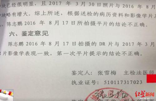 玉佩致胸片陰影誤診?四川勞研科技有限公司體檢顯示正常 男子一年后去世-易網健康養生網 玉佩致胸片陰影誤診?四川勞研科技有限公司體檢顯示正常 男子一年后去世