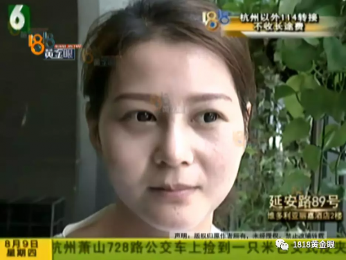 想要“柔美”結(jié)果寧波益寶醫(yī)療美容把她整像豬頭？