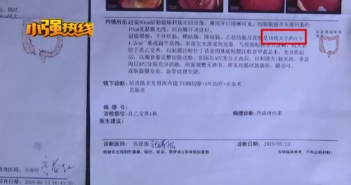 杭州醫博肛泰醫院檢查報告單與醫生描述有出入？是1顆息肉還是18顆息肉？