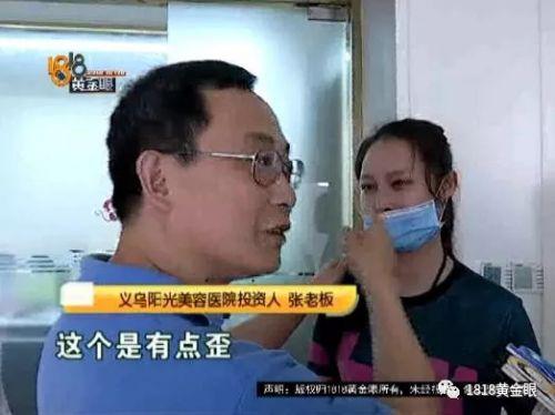 三女子整容均出現不同程度歪斜 義烏陽光美容醫院：本身就有問題