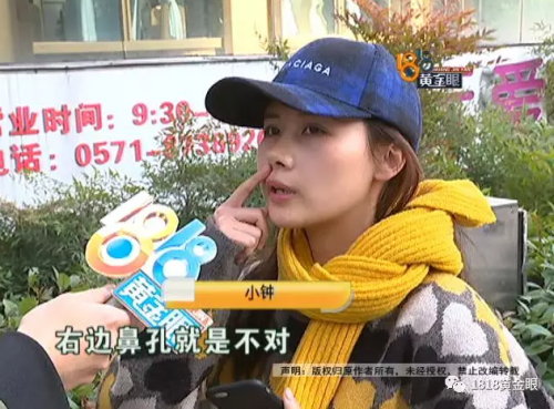 杭州愛琴海醫療美容醫院整鼻后鼻孔不對稱 朋友看到都不敢做了