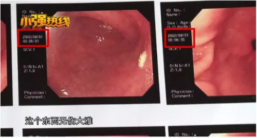 杭州醫博肛泰醫院檢查報告單與醫生描述有出入？是1顆息肉還是18顆息肉？