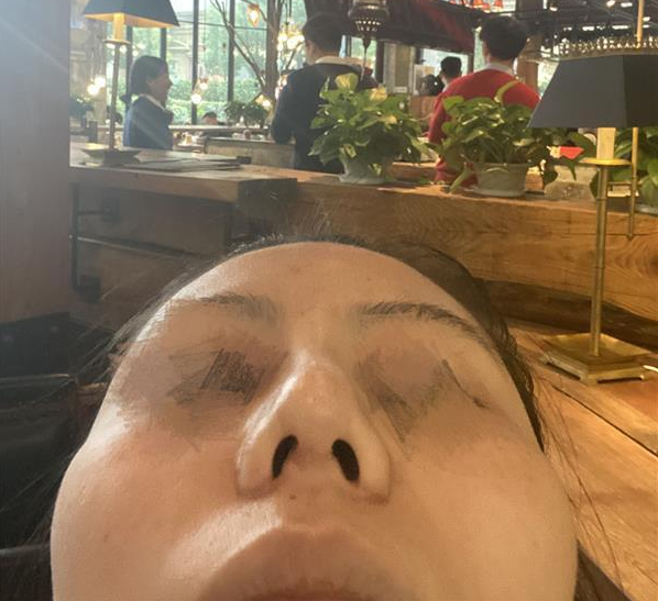 女主播在武漢熙蒙整形后精神幾近崩潰 覺得隆鼻后更丑了