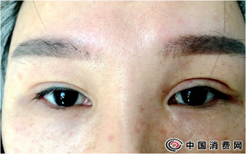 河南整形美容醫院怎么樣？整形屢次失敗 患者投訴不斷