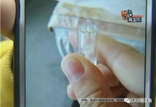 蕾特恩專業祛痘寧波百丈店：你的臉很嚴重 姑娘嚇的貸款三萬祛痘卻沒效果