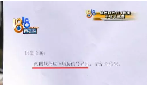 臉上兩個硬塊 她懷疑和杭州亞美宏韓整形手術有關