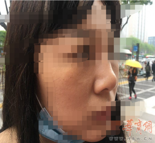 西安藝星美容整形醫院:醫美沒有統一標準 鼻子凹凸不平屬于正常-易網健康<a href=http://m.henggaotouzi.com/jkys/ target=_blank class=infotextkey>養生</a>網 西安藝星美容整形醫院:醫美沒有統一標準 鼻子凹凸不平屬于正常