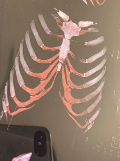 南京普羅普姿醫療美容門診做假手術？神操作！劃個口子就當取了肋骨