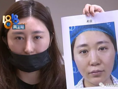 韓國籍名醫、萬元美容針——高端美容竟是“三無”騙局