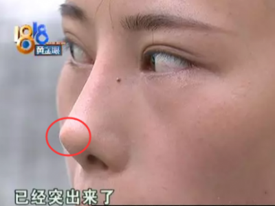 江蘇6兒童敷“三伏貼”出現不良反應 涉事醫生被指非法行醫