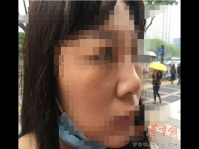 西安藝星美容整形醫(yī)院：醫(yī)美沒(méi)有統(tǒng)一標(biāo)準(zhǔn) 鼻子凹凸不平屬于正常