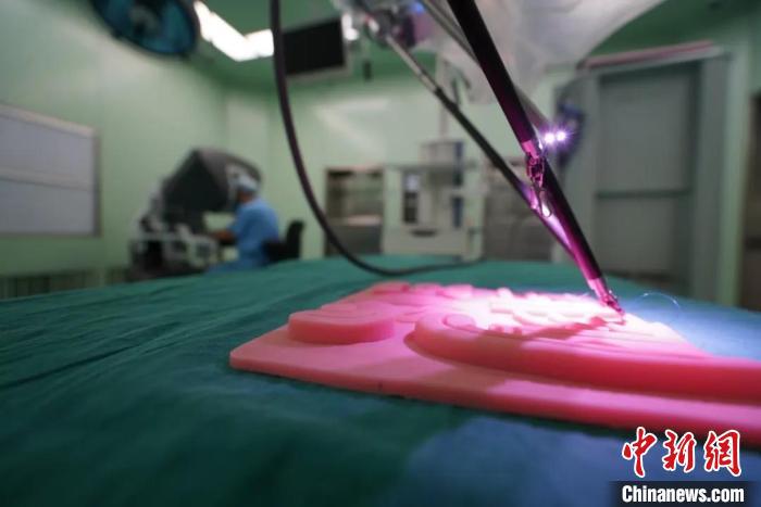 國內(nèi)首臺(tái)兒科醫(yī)院達(dá)芬奇手術(shù)機(jī)器人完成手術(shù)超100例