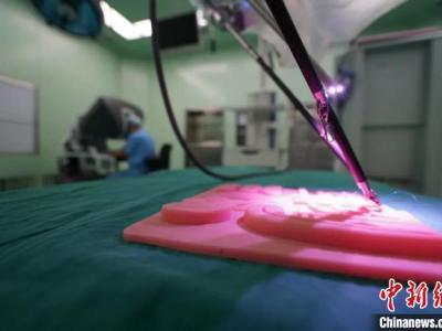 中國首臺兒科醫院達芬奇手術機器人進行手術超100例