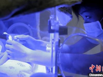 匯報(bào)稱：中國(guó)極早產(chǎn)兒、極低出世休重早產(chǎn)兒存活率明顯提高