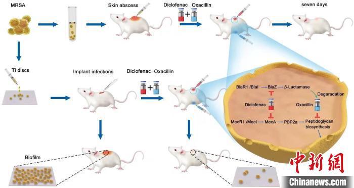 專家發現骨關節術后感染防治新策略：傳統藥物對抗超級耐藥菌“顯身手”