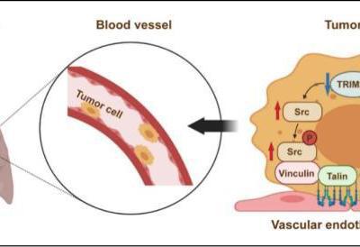學者發現常用靜脈麻醉藥丙泊酚或增加腫瘤侵襲、轉移風險