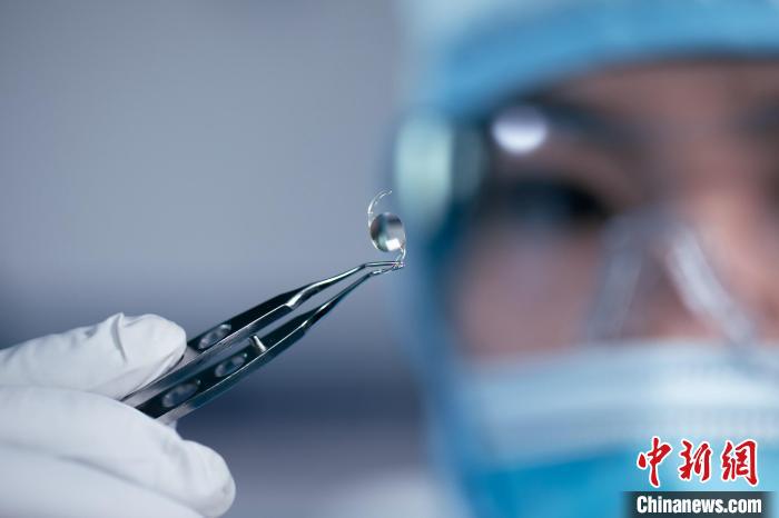 國家重點研發計劃項目新一代人工晶狀體進入臨床階段