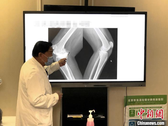 大骨節(jié)病公益項(xiàng)目：已為西藏244位大骨節(jié)病患者進(jìn)行關(guān)節(jié)置換手術(shù)