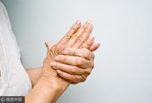 喝水加它竟能防痛風？尿酸高牢記6大飲食禁忌可保命！