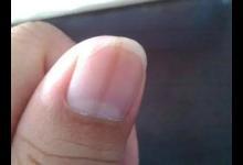 指甲已經發(fā)出健康預警了，你還蒙在鼓里！