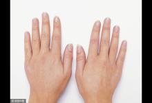 身體出現這3個信號，說明體內有癌細胞