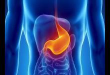 9成胃癌發現就是晚期！