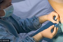 腳腫、腳痛，6個腳上癥狀告訴你，身體早有疾病！