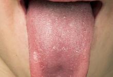 早秋祛濕不用愁，讓我們輕松解決它