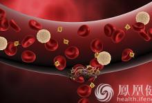 99%的血栓無征兆！記住一個字，就能遠離全身血栓