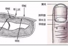 指甲發黃是肺不好？月牙少是胃有問題？指甲的6大傳言，你信了嗎？