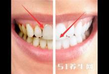 刷牙到底用熱水還是冷水好？搞錯這一點，難怪天天刷牙還是大黃牙